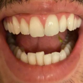 Luxe Dental Cosmetics - General Dentistry Near Me - Los Angeles, California