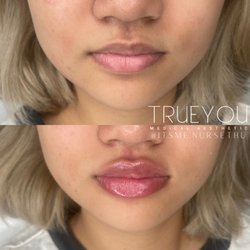 True You Medical Aesthetic - Nurse Thu