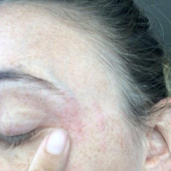 Super 8 by Wyndham Crestview - Bug bites on my eye - Hotels Near Me - Crestview, Florida Super 8 by Wyndham Crestview - Bug bites on my eye - Hotels Near Me - Crestview, Florida