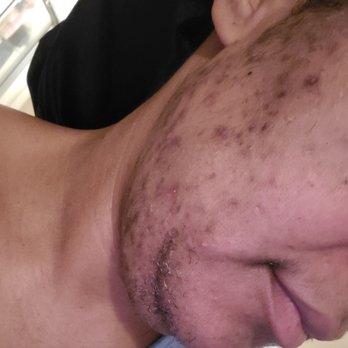 Simply Amazing Skin Care - 2nd session - Skin Care Near Me - Hampton, Virginia