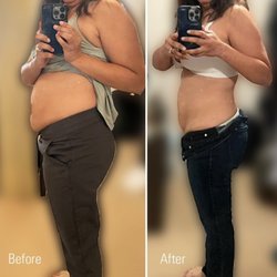 Medical Weight Loss