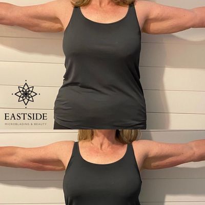 Cryo Fat Sculpting - We offer non-invasive Cryo Fat Sculpting & Skin Tightening with a industry leading topical fat removal system. This method is more effective and cost effective compared to Coolsculpting treatments, and help you permanently eliminate fat in the stomach, arms, double chin, legs, and bra fat areas.

Call today to schedule our LIMITED TIME $199 intro Cryo Promo Session!