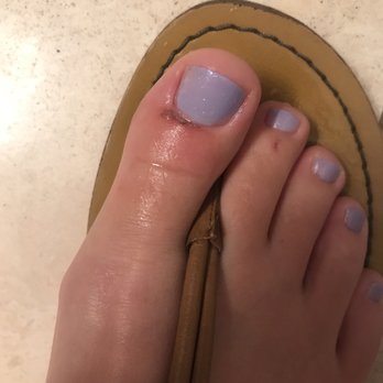 Asia Nails Salon - Strange cut on my toe fro my pedicure that I'm very unhappy with - Nail Salons Near Me - Chicago, Illinois Asia Nails Salon - Strange cut on my toe fro my pedicure that I'm very unhappy with - Nail Salons Near Me - Chicago, Illinois