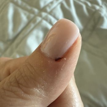 M3V The Nail Bar - Thumb cut that didn't get cleaned until I asked before the top coat was applied. Still some dried blood left. - Nail Salons Near Me - Phoenix, Arizona