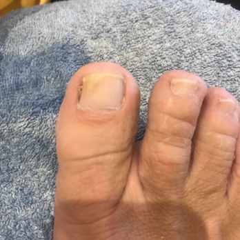Austin Foot and Ankle Specialists - Many months of continuous use but this is the after! Very impressed - Podiatrists Near Me - Austin, Texas