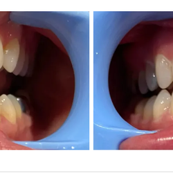 Alora Wellness Spa - Teeth Whitening, Alora Wellness Spa, Eugene, OR