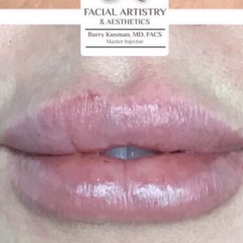 Barry Kusman, MD, FACS - Before and after! - Skin Care Near Me
