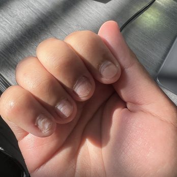 X Nails - Damage nail from the salon with yellow stain - Nail Salons Near Me - Lewisville, Texas X Nails - Damage nail from the salon with yellow stain - Nail Salons Near Me - Lewisville, Texas