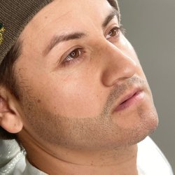 Scalp Prodigy - Scalp Micropigmentation for the beard.