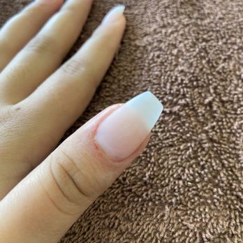 Pearl's Nails - Cuts received on both hands - Nail Salons Near Me - Garden Grove, California Pearl's Nails - Cuts received on both hands - Nail Salons Near Me - Garden Grove, California