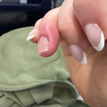 La Bella Nail Salon - chronic cuticle infection - Nail Salons Near Me - Brooklyn, New York La Bella Nail Salon - chronic cuticle infection - Nail Salons Near Me - Brooklyn, New York