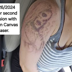 Clean Canvas Laser