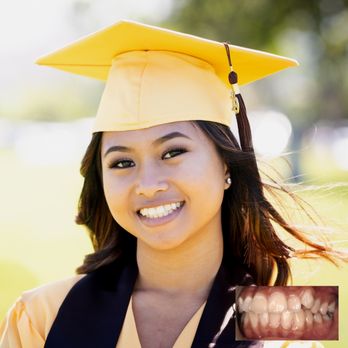 Holliday Orthodontics - Before and after Invisalign - Orthodontists Near Me - Honolulu, Hawaii Holliday Orthodontics - Before and after Invisalign - Orthodontists Near Me - Honolulu, Hawaii