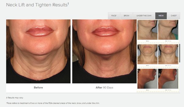 Lucali Aesthetic Medicine by null