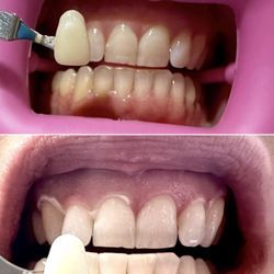 SoCal Electrolysis