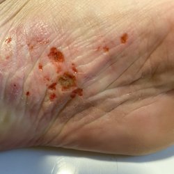 Lv Nails - My foot after a pedicure at LV nails