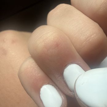 Kauai Nail Spa - Hard to see how red, but I'm bleeding on my pinky and ring finger - Nail Salons Near Me - Kapaa, Hawaii