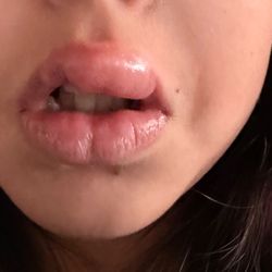 Oral & Maxillofacial Surgery Associates - She is hurt and in pain after the failure procedure