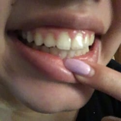 Family Dental Group - They're are not aligned and the others next to the k9 is being pushed back