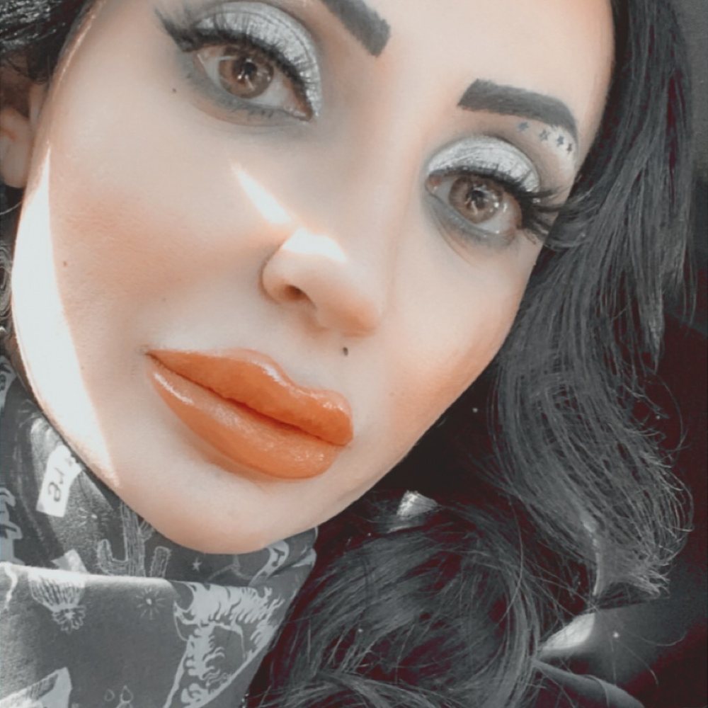 Cloud 9 Medi Spa - Lip filler and Botox in brows, forehead and eye area done by Kim - Medical Spas Near Me - Yucaipa, California Cloud 9 Medi Spa - Lip filler and Botox in brows, forehead and eye area done by Kim - Medical Spas Near Me - Yucaipa, California