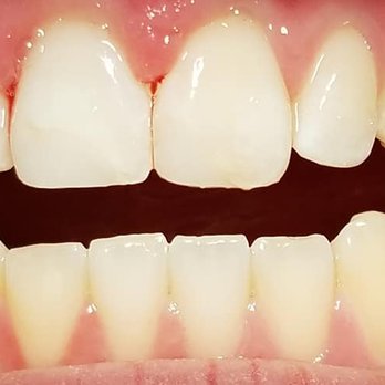 1. Clare Macaulay, DDS