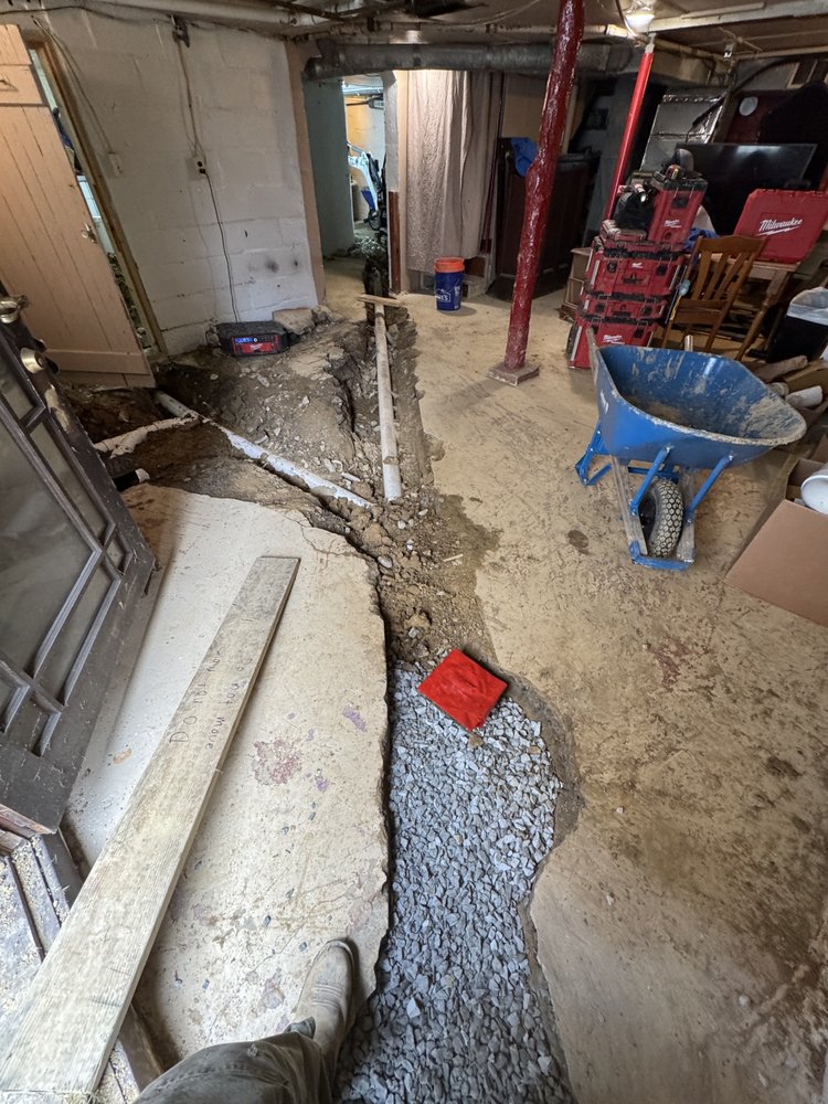 Slide of Pfeuffer Contracting