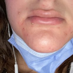 La Jolla Acne Specialists