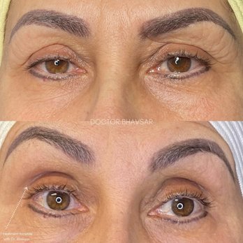 Brea Wellness Center - Laser Hair Removal Near Me - Fullerton, California Brea Wellness Center - Laser Hair Removal Near Me - Fullerton, California
