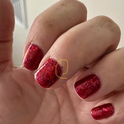 Amy Nails - More scabs where she cut my cuticles until they bled