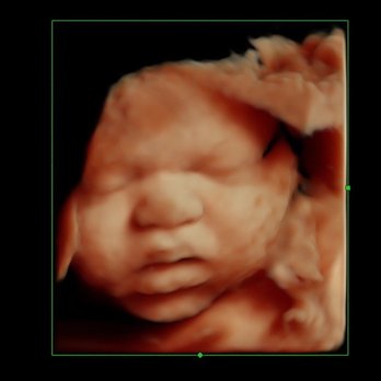 TrueView Ultrasound - Ultrasound Imaging Centers Near Me - Roseville , California TrueView Ultrasound - Ultrasound Imaging Centers Near Me - Roseville , California