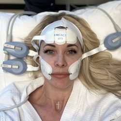 Engineered Aesthetics Plastic Surgery Institute - Emface