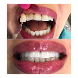 Potomac Dental Group