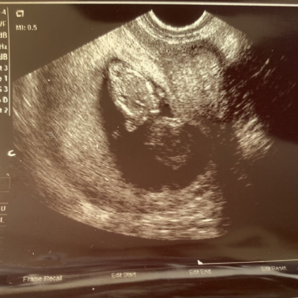 New Body Acupuncture - Pregnancy photos - Acupuncture Near Me - Beverly Hills, California New Body Acupuncture - Pregnancy photos - Acupuncture Near Me - Beverly Hills, California