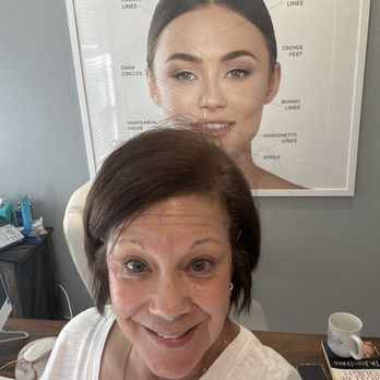 Lilly Beauty - Medical Spas Near Me - Walnut Creek, California