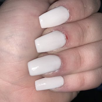 Sweet Nails - Terrible shape, bleeding / swollen around my nail bed - Nail Salons Near Me - Las Vegas, Nevada