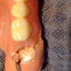Pioneer Denture Clinic - Never go here. Piece of junk and only 10 months old. Out 1600.00