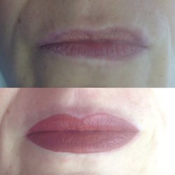 Schönheitspraxis Morgenstern - Lippen pigmentierung