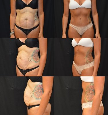 Baroody Plastic Surgery by null