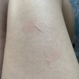 a closeup of a person's legs with a red spot a closeup of a person's legs with a red spot