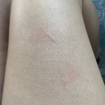 Subway - a closeup of a person's legs with a red spot - Sandwiches Near Me - Ames, Iowa Subway - a closeup of a person's legs with a red spot - Sandwiches Near Me - Ames, Iowa