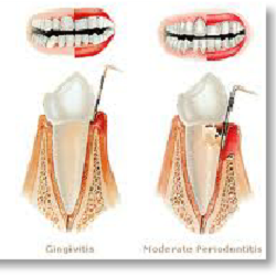 Congressional Dental Care - Periodontist Rockville, MD