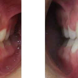 Laird Orthodontics - Affordable Orthodontic Treatment for Everyone Interest FREE Financing up to 22 Months ZERO Down Payment for your Treatment* LOW Monthly