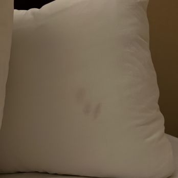 Embassy Suites by Hilton Birmingham - Stain on pillow - Hotels Near Me - Birmingham, Alabama Embassy Suites by Hilton Birmingham - Stain on pillow - Hotels Near Me - Birmingham, Alabama