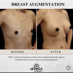 Tim Neavin - Plastic surgeon Santa Barbara