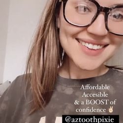 AZ Tooth Pixie - Teeth Whitening