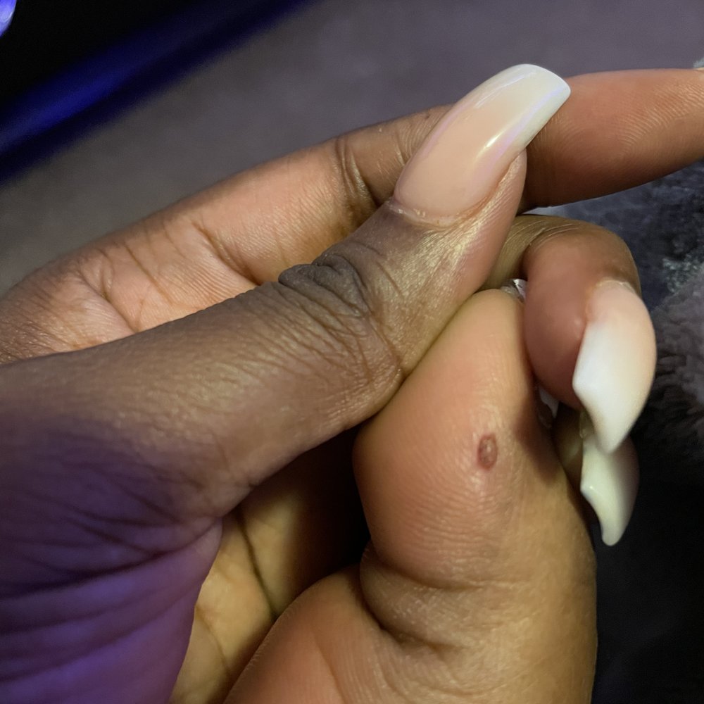 Shark Nail Bar - A few days later - Nail Salons Near Me - Lithonia, Georgia Shark Nail Bar - A few days later - Nail Salons Near Me - Lithonia, Georgia