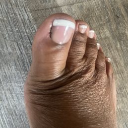 Black mark on big toe Black mark on big toe