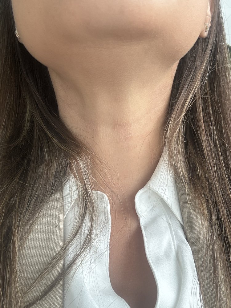 MICHAEL MOSHER, MD Updated September 2024 24 Reviews 415 Rolling