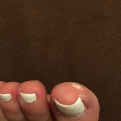 Thanh Mai nails & Wellness - So sollte das dann bitte nicht aussehen :/