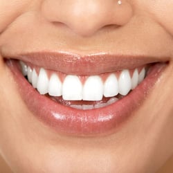 M S Vibbert, DDS